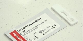 Niški stručnjaci napravili test na Covid-19 koji predviđa tok bolesti etiketa